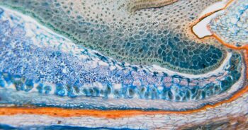 The Yin-Yang sides of retrotransposons